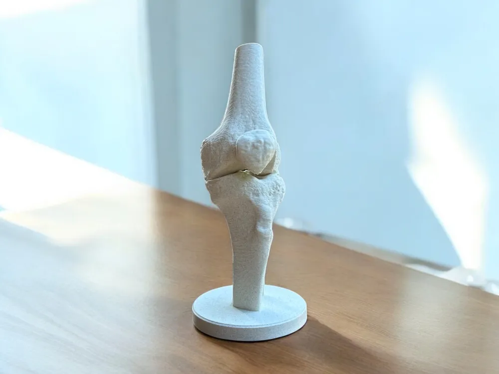 실제 CT 기반 해부학적 무릎 모델